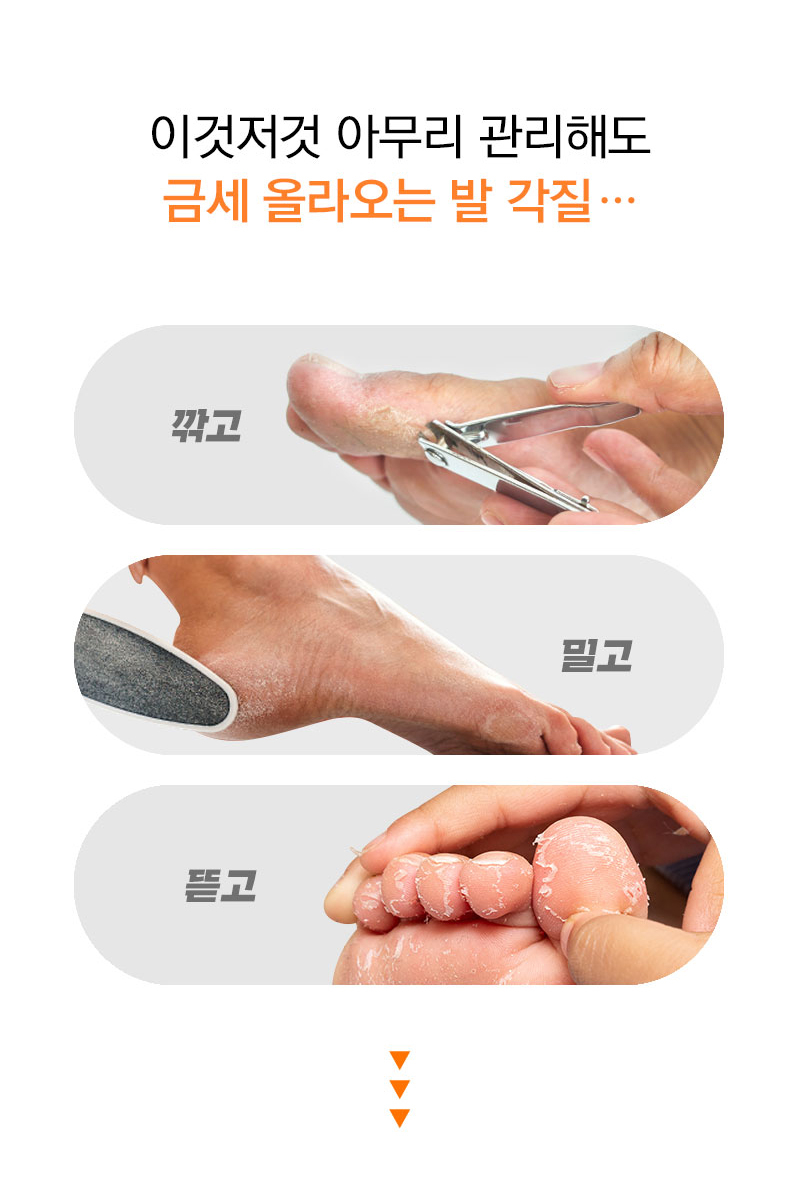 G마켓 - 만능풋크림 발바닥 발뒤꿈치갈라짐 각질연화제 보습제