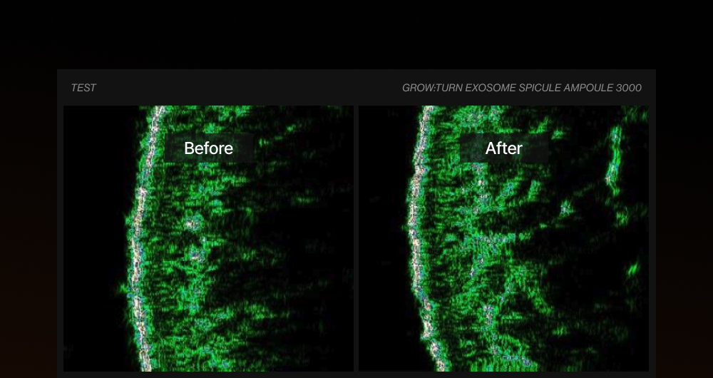 LILYEVE Growturn Exosome Spicule Ampoule 3000 - description 42