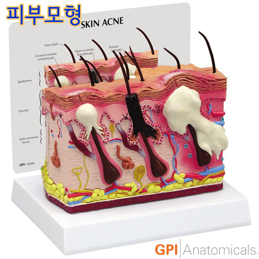 더미통상