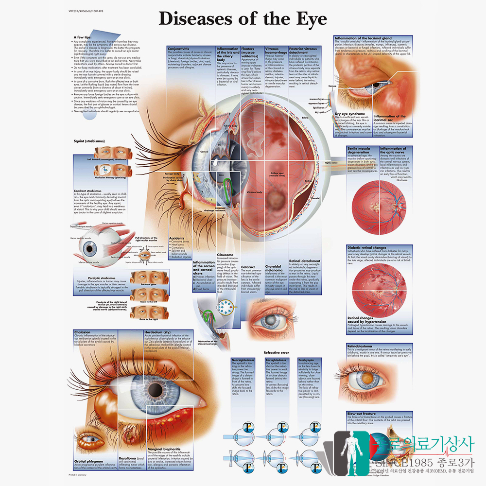 Alphabetical List Of Eye Diseases And Disorders Alphabetical List Of Eye Diseases And Disorders