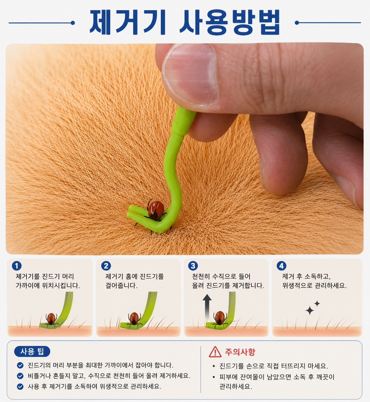 강아지 진드기 제거 제거기 위생 관리 도구 반려동물 고양이 핀셋 집게 쪽집게 4종 세트 상세 이미지 5
