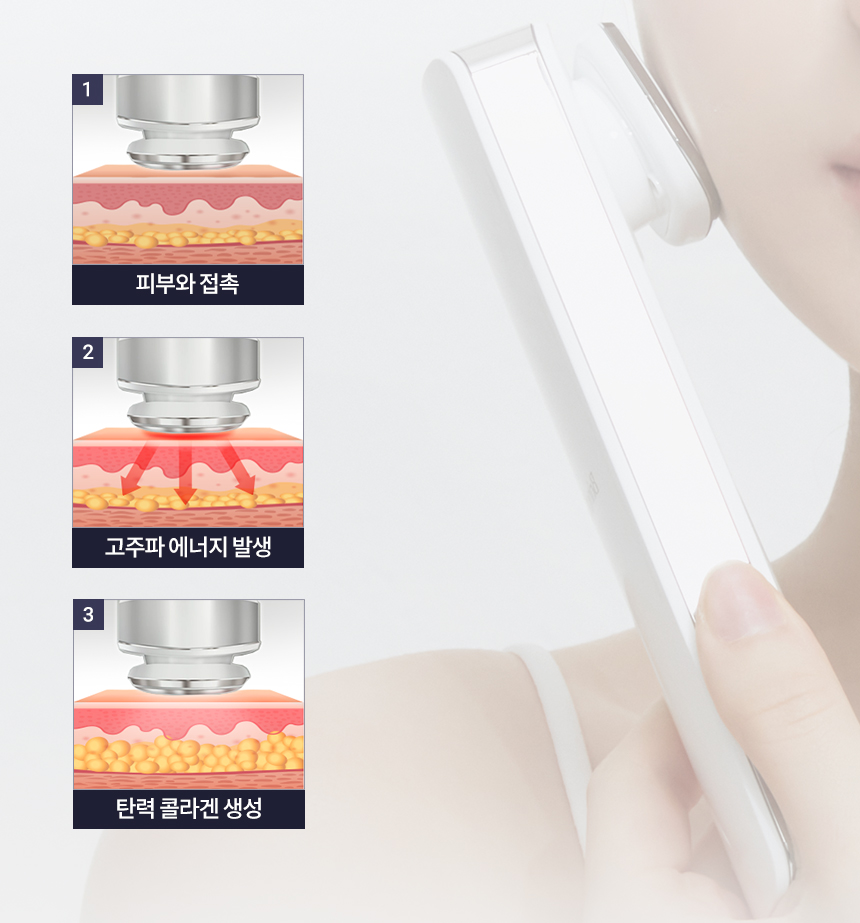 브링백 튠리프팅 킬샷 상세 이미지 36