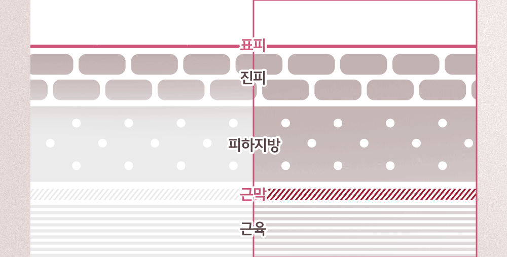 바디프랜드 미니 마사지 플레이트 상세 이미지 17