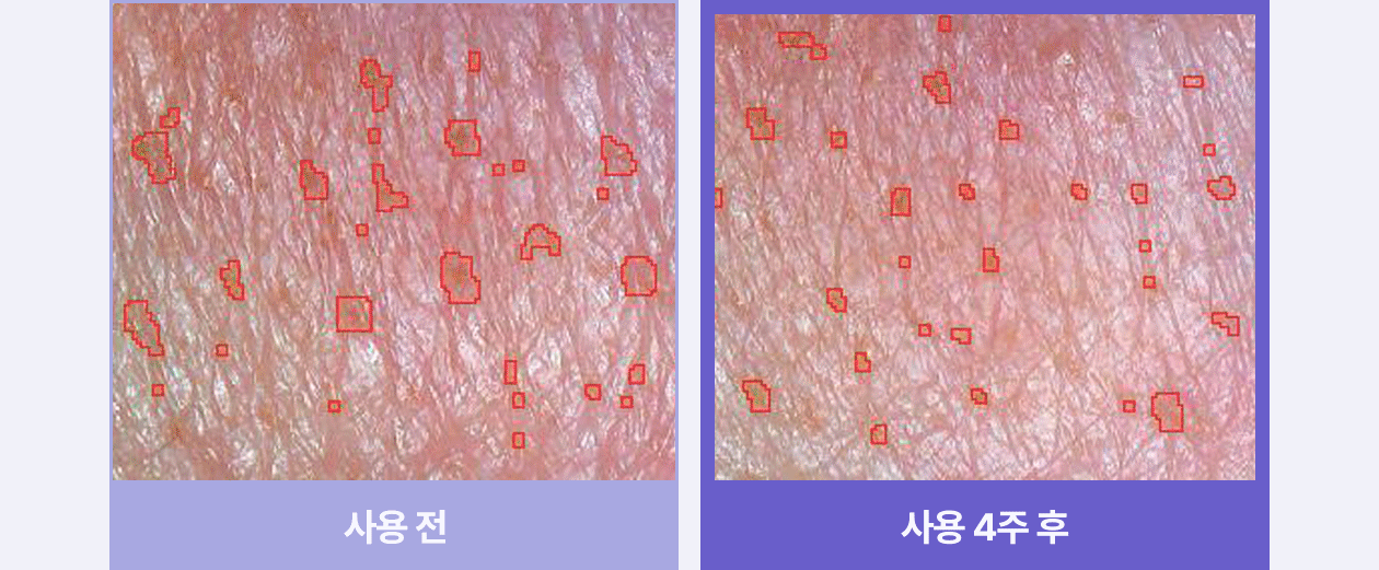 rejuran PDRN sheet mask