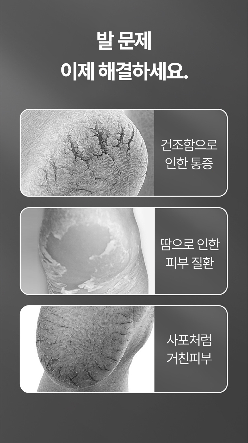 %EB%B0%9C%EB%92%A4%EA%BF%88%EC%B9%98-%EB%B3%B4%EC%8A%B5%EC%96%91%EB%A7%90_05.jpg